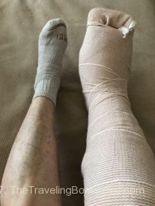 Ankle Cast Outfits, Cast Ideas Leg, Outfits With Leg Cast, Post Ankle Surgery Recovery, Ankle Surgery Recovery Tips, Ankle Fracture Recovery, Lower Leg Exercises, Ankle Surgery Recovery, Broken Ankle Recovery