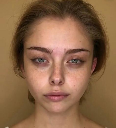 Homeless Makeup Look, Beautiful Insecurities Eye Bags, Sick Beauty Aesthetic, Dark Eye Circles Aesthetic, Makeup With Eyebags, Eyebags Makeup Aesthetic, Tired Aestethic Eyes, Sunken Eyes Aesthetic, Sick Girl Makeup