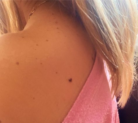 Small heart tattoo freckle dainty tattoo Tattoo On Birthmark, Heart Birthmark Aesthetic, Tiny Freckle Tattoo, Tattoos On Birthmarks, Tattoos With Freckles Arms, Small Brown Heart Tattoo, Heart Beauty Mark Tattoo, Heart Shaped Freckle Tattoo, Heart Tattoo Freckle