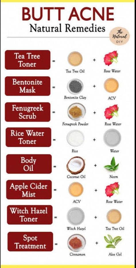 3 Best Remedies For Back Acne https://overdoseofhealth.com/3-best-remedies-for-back-acne/ https://overdoseofhealth.com/3-best-remedies-for-back-acne/ Remedies For Back Acne, Natural Remedies For Acne, Back Acne Remedies, Tea Tree Toner, Cystic Acne Remedies, Remedies For Acne, Back Acne, Witch Hazel Toner, Bad Acne