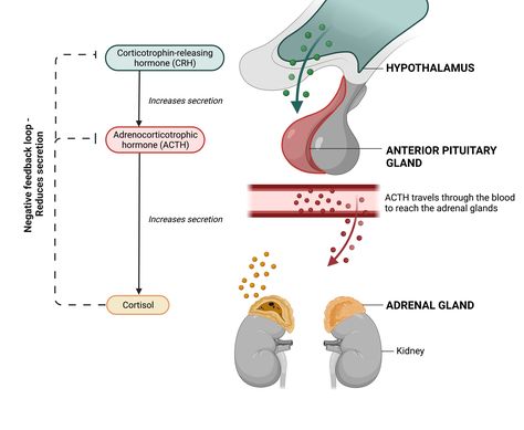 Pathophysiology Of Addison’s Disease    Addison’s disease is a rare endocrine disorder also know as Primary adrenal insufficiency which happens when the adrenal gland is not able to produce enough hormones the body needs, particularly the aldosterone and cortisol hormone. The adrenal gland has 3 layers or zones  ￼  	•	Zona glomerulosa: This is the outer most layer and it secretes aldosterone. Aldosterone belong to a hormone family ( RAAS ) Renin-Angiotensin-Aldosterone-System.  	⁃	Renin: a protein enzyme which stimulates the production of aldosterone  	⁃	Angiotensin II: Stimulates the adrenal cortex to produce aldosterone  	⁃	Aldosterone: This is a steroid hormone produced by the adrenal cortex, which plays a crucial role in regulating electrolyte balance, fluid balance, and blood pressure Adrenal Gland Hormones, Cortisol Hormone, Anterior Pituitary, Electrolyte Balance, Adrenal Gland, Adrenal Cortex, Endocrine Disorders, Pituitary Gland, Adrenal Glands