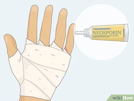 How to Heal Cracked Skin (with Pictures) - wikiHow How To Heal Cracked Fingers, Cracked Finger Tips, Dry Cracked Hands Remedy, Cracked Hands Remedy, Cracked Fingers, Dry Cracked Hands, Chapped Hands, Cracked Hands, Skin Hand