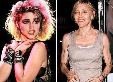 Madonna Now, Then And Now Photos, Then Vs Now, Celebrities Then And Now, Celebrities Before And After, Strange Photos, Betty White, Aging Well, Glam Rock