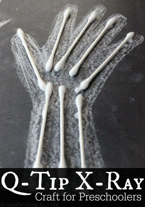 Introduce your preschooler to the bones of the body as part of an All About Me or My Body theme with this fun x-ray craft made out of Q-Tips! Infants Crafts, Bones Of The Body, Body Preschool, Homework Ideas, Craft Preschool, Body Bones, All About Me Preschool, Body Craft, Preschool Projects