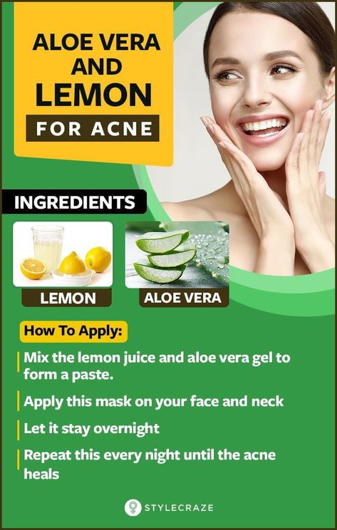 #HealthNutritionFood Aloe Vera For Acne, Acne Beauty, Aloe Vera For Skin, Treating Acne, Aloe Vera Skin Care, Skincare Acne, Aloe Vera Face Mask, Get Rid Of Acne, Rid Of Acne