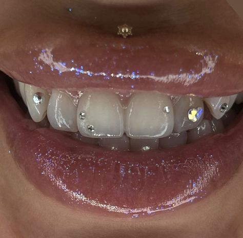 Colorful Tooth Gems, Teeth Gem Designs, Tooth Gem Design Ideas, Simple Teeth Gems, Piercing No Dente, Teeth Jewelry Tooth Gems, Teeth Gems Ideas, Tooth Gem Placement, Gem Teeth