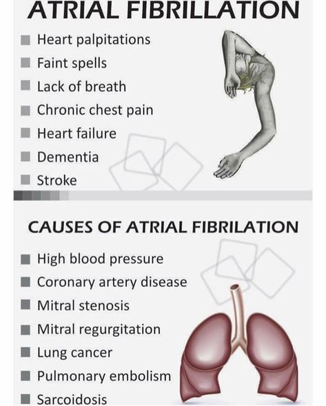 Afib Atrial Fibrillation, Atrial Fibrillation Symptoms, Low Estrogen Symptoms, Cardiac Nursing, Low Estrogen, Respiratory Therapy, Atrial Fibrillation, Nursing School Studying, Nursing School Tips