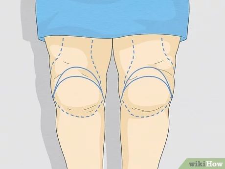 Fat Legs How To Get Rid Of, Knee Fat Exercises Inner, How To Get Rid Of Thigh Dimples, Knee Fat Exercises Get Rid Of, Fatty Knees Get Rid Of, How To Slim Down Your Knees, Exercises For Legs And Thighs, Slimmer Knee Workout, Tone Knees