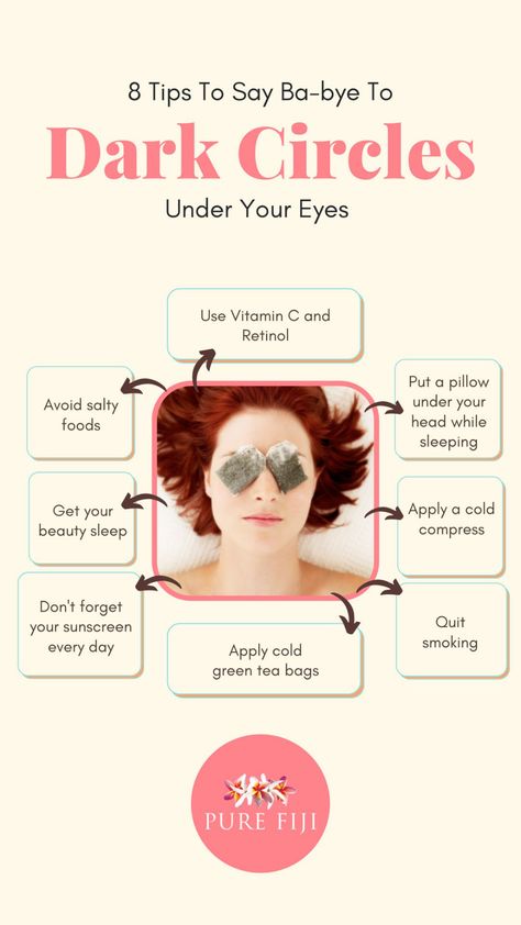 Dark Eye Bags, Cold Green Tea, Dark Circle Remedies, Blind Pimple, Pimples Under The Skin, Dark Eye Circles, Under Eye Mask, Natural Acne Remedies, Remove Dark Circles