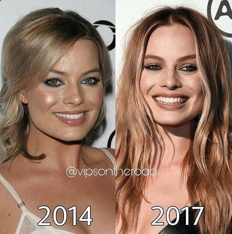 Margot Robbie is ageless 🙌🏻we love her! Happy Monday to all of our beautiful clients. • • �• • • #botox #botoxfiller #lipinjections #lipaugmentation #smile #instagood #injections #beautiful #beauty #beforeandafter #transformation #cosmetics #cosmeticsurgery #cosmeticnurse #plasticsurgery #injectables #nurseinjector #lips #perfectpout #fillers #sandiego #laser #laserhairremoval #avalonlaser #micropeeling #skinrejuvenation #acne #skintightening Kardashian Plastic Surgery, Contouring Tips, Lip Augmentation, Cosmetic Dermatology, Botox Fillers, Lip Injections, Makeup Tricks, Medical Spa, Med Spa