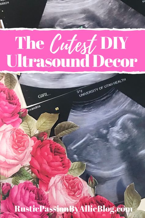 This is the cutest idea to display your ultrasound pictures. Whether you are looking for ultrasound announcement ideas, baby shower decor ideas, or just a fun DIY nursery decoration this is it. It's a great way to have a keepsake from your pregnancy you can display in your home. #nurserydecor #pregnancyannouncement #ultrasoundpictures #babyannouncement #diynurserydecor Ultrasound Room Decor, Display Ultrasound Pictures, What To Do With Sonogram Pictures, Ideas For Ultrasound Pictures Display, What To Do With Ultrasound Pictures, Ultra Sound Picture Ideas, Ultrasound Keepsake Ideas, Sonogram Picture Ideas Display, Ultrasound Pictures Display