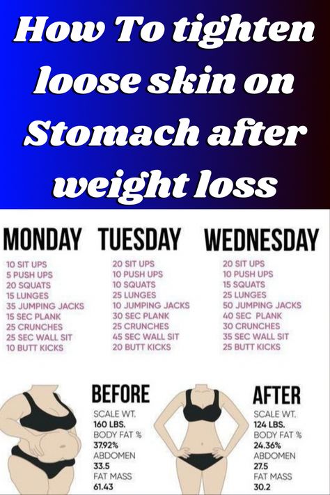 Workout For Loose Skin, Workout To Tighten Loose Belly Skin, Workouts To Tighten Loose Skin, Sagging Stomach Exercise, Exercises For Loose Skin, Skin Tightening Workout, Tone Loose Belly Skin, Exercise For Loose Belly Skin, How To Tone Loose Belly Skin