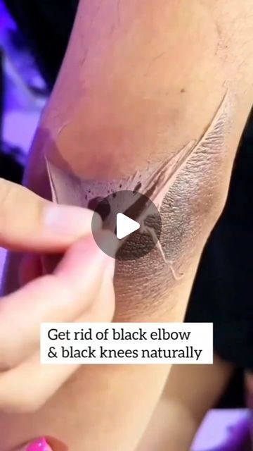 Pihu officials on Instagram: "Get Rid of Dark Elbow/Knees Naturally   . . . #darkelbows #dark #viralreels #trandingreels #skincareblogger #skincare #darkknees #darkelbowandknees #instagramreels #instagood" Skin Tan Removal, Cracked Heel Remedies, Dark Spots On Legs, Dark Elbows, Spots On Legs, Diy Skin Care Routine, Dark Underarms, Dark Spots On Skin, Beauty Tips For Glowing Skin