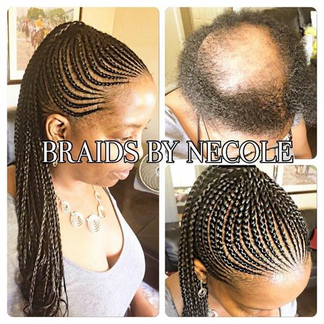 African American Braid Styles, Summer Cornrows, Alopecia Hairstyles, Cornrow Ponytail, Cornrow Braids, African Blouses, African American Braids, American Hairstyles, Bald Head