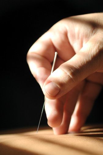 The Benefits of Acupuncture You Didn't Know Acupuncture Benefits, Tennis Elbow, Joints Pain Relief, Carpal Tunnel, Menstrual Cramps, Low Back Pain, Sciatica, Acupressure, Migraine