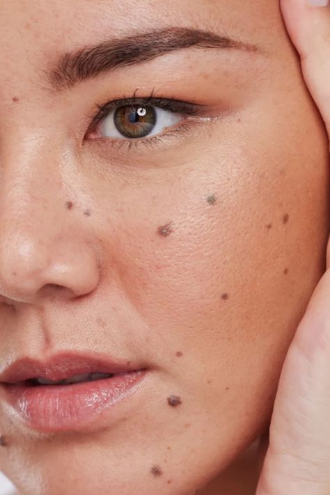 Face Beauty Marks, Beauty Marks On Face Meaning, Beauty Marks Aesthetic, Moles Aesthetic, Moles On Face Aesthetic, Models With Moles On Face, Mole Above Lip Beauty Marks, Mole On Face, Red Birthmark On Face