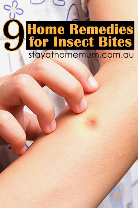 If you are one of those people that insects love to bite, here's some great home remedies to try! Bug Bite Swelling, Remedies For Bug Bites, Mosquito Bite Itch, Itchy Bug Bites, Bug Bites Remedies, Bug Bite Relief, Bite Relief, Insect Bite, Living In Australia