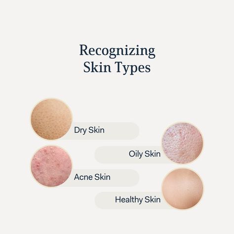 Based on the images, tell us what your skin type is? Do you need help with identifying? Comment Skin Type and we’ll personally help you walk through your skin type and find the best products for you. Comment below 👇🏽 English Presentation, Bridal Skin, Bridal Skin Care, Oily Skin Acne, Type Illustration, Beauty Clinic, Holistic Beauty, Skin Prep, Acne Skin