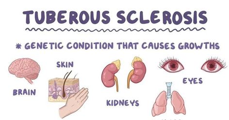 Tuberous Sclerosis, Case Presentation, Medical Anatomy, Coping Strategies, Medical Students, Medical School, Anatomy, Medicine, Presentation