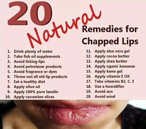 Chapped lips Remedies For Chapped Lips, Chapped Lips Remedy, Dry Skin Diy, Home Remedies For Allergies, Lip Care Diy, Natural Remedies For Migraines, Dry Skin Remedies, Beauty Regime, Home Remedies For Hair