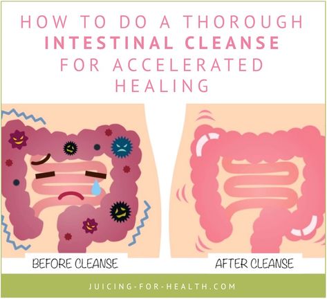 Whole Body Cleanse, Intestinal Cleanse, Natural Detox Cleanse, Body Detox Cleanse, Parasite Cleanse, Cleanse Detox, Natural Detox Drinks, Natural Colon Cleanse, Detox Drinks Recipes