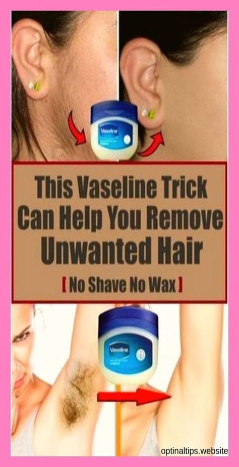 This Vaseline Trick Can Help You Remove Unwanted Hair Back Hair Removal, Electrolysis Hair Removal, Hair Remove, Ingrown Hair Removal, Remove Unwanted Hair, Underarm Hair Removal, Endocannabinoid System, Unwanted Facial Hair, Hair Removal Methods