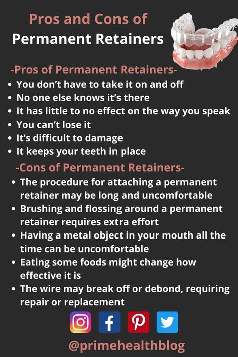 Retainers For Teeth, Retainers After Braces, Teeth After Braces, Permanent Retainer, Retainer Teeth, After Braces, The Wire, Metal Wire, Pros And Cons