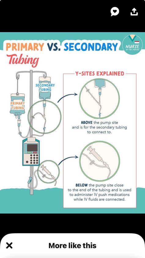 Iv Sites Nursing, Iv Sites, Nursing Iv, Study Sheets, General Medicine, Nursing School Essential, Iv Fluids, Nursing School Humor, Fundamentals Of Nursing