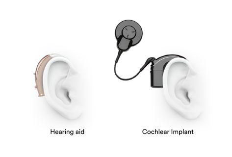 Rediscover the sounds you've been missing | Cochlear Cochlear Implants, Cochlear Implant, Music Appreciation, Health Insurance Plans, Hearing Loss, A New World, Hearing Aids, Next Step, The Next Step