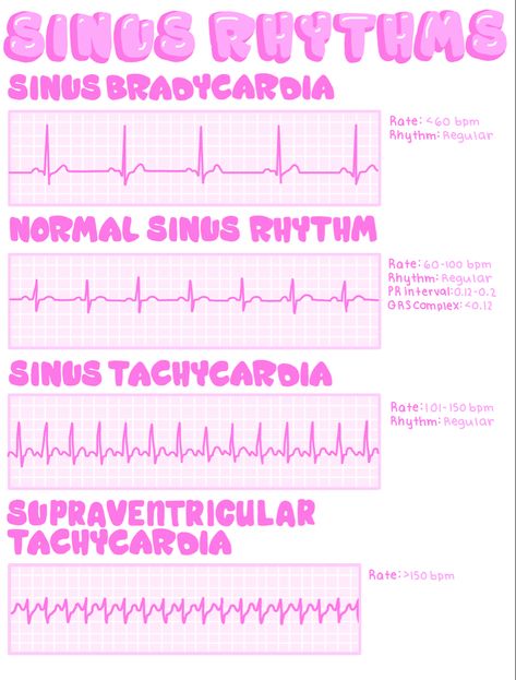 EKGs Ekg Mnemonics, Ekg Notes, Easy Ekg Interpretation Cheat Sheets, Ekg Rhythms Cheat Sheets, Ekg Interpretation Made Easy Cheat Sheets, Ekg Technician, Cardiac Rhythms Cheat Sheets, Ekg Technician Aesthetic, Cardiac Dysrhythmias Cheat Sheets