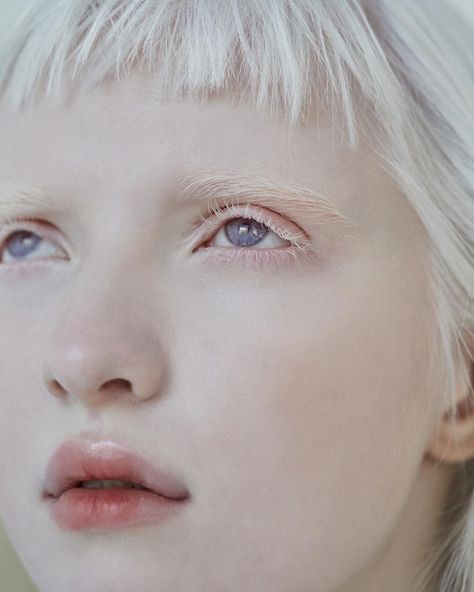 Nastya Zhidkova Nastya Zhidkova, Albino Model, Albino Girl, Photographie Portrait Inspiration, Angel Aesthetic, Face Reference, Face Photography, Art Reference Poses, Pretty People