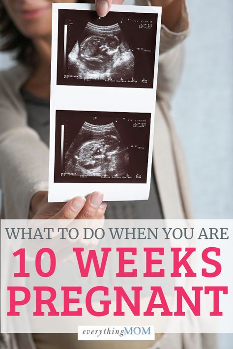 10 Week Ultrasound Pictures, 10 Weeks Pregnant Ultrasound, Baby At 10 Weeks, 10 Week Ultrasound, 9 Weeks Pregnant, 10 Weeks Pregnant, Fetal Heart Rate, Pregnancy Calendar, Ultrasound Pictures