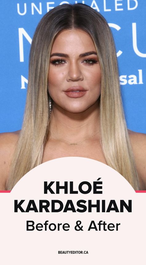 Khloe Before And After, Khloe Kardashian Hair, Khloe K, Kloe Kardashian, Khloé Kardashian, Being A Parent, Famous Last Words, Movie Collection, Human Being