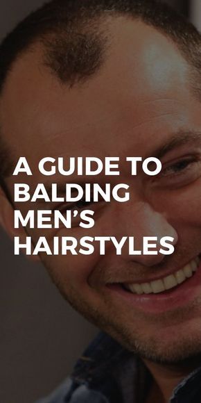 Bald Hairstyles Men Thinning Hair, Mens Hairstyles Balding, Thinning Hairstyles Men, Men’s Balding Haircut, Mens Haircut For Balding Men, Haircut Balding Men, Wide Forehead Hairstyle Men, Men Shaved Head Style, Balding Man Haircut