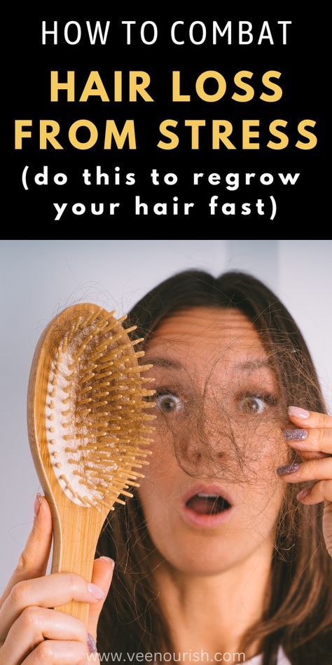 Loss Of Hair Remedies, Vitamins For Loss Of Hair, How To Stop Hair From Falling Out, Hair Lossing Tips Natural, Hair Lossing Tips, Hairloss Hairstyles, Hair Growth Serum Diy, Black Boy Hairstyles, Androgenic Alopecia