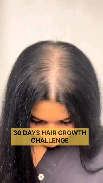 Hair Fall Remedy Home, Hair Thickening Remedies, Thicken Hair Naturally, Hair Fall Remedy, Growth Challenge, Regrow Hair Naturally, Hair Care Oils, Hair Growth Challenge, Hair Fall Solution