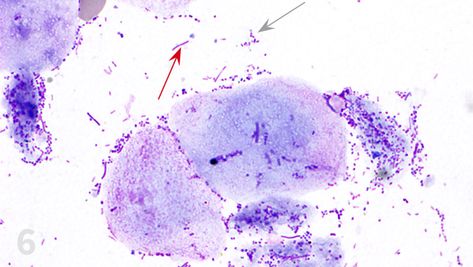 Image Gallery: Ear Cytology | Clinician's Brief Veterinary Ear Cytology, Ear Cytology Veterinary Chart, Ear Cytology Veterinary, Vet Medicine, Tech Skills, Vet Med, Veterinary Medicine, Red Arrow, Work With Animals