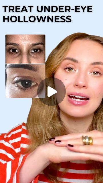 Hollowness Under Eyes, Hollow Eyes Exercise, Under Eye Hollows Exercise, Under Eye Hollows Remedies, How To Get Pink Cheeks Naturally, Hollow Eyes Makeup, Hollow Under Eyes, Under Eye Hollows, Hollow Eyes