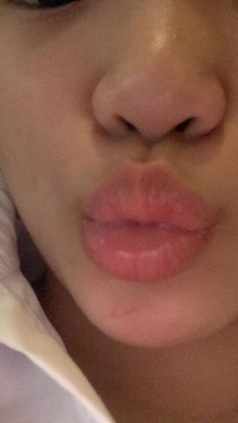 Lip Pics Aesthetic, Lips Asthetic Picture, Lips Selfie Ideas, Shh Aesthetic Lips, Mouth Pictures Lips Aesthetic, Bitten Lips Aesthetic, Instagram Food Pictures, Lips Photo, Hospital Admit Hand Pics