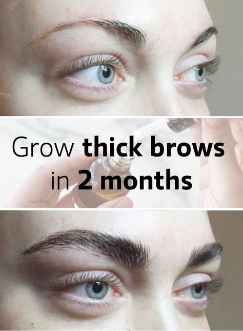 you really need this recipe : take it now Make Eyebrows Grow, How To Make Eyebrows, Thicker Eyebrows Naturally, Grow Eyebrows Thicker, Sparse Eyebrows, How To Grow Eyebrows, Thick Brows, Eyebrow Growth, Threading Eyebrows