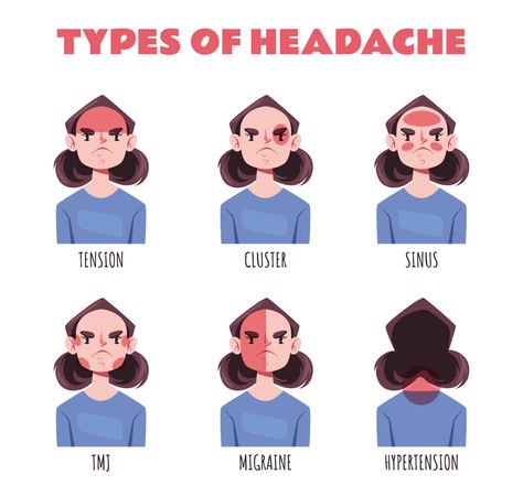 Headache Location Analysis: What They Mean For You Headache Location Meaning, Headache Location, Different Headaches, Occipital Neuralgia, Location Analysis, Referred Pain, Headache Types, Dr Book, Health Podcast