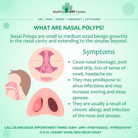 Nasal Polyps, Nasal Cavity, Sinus Infection, Best Doctors, Cavities, Headache, Allergies, Surgery