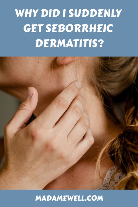 Do you feel that your seb derm rash happened all of a sudden? Desperate to find out why you got seborrheic dermatitis? Find out what can trigger seb derm and how to prevent it from coming back. Dermitis On Face, Contact Dermitis Rash, Sebhorric Dermitis, Sebboric Dermitis Scalp, Seborrheic Dermitis On Face, Seborrheic Dermitis On Scalp, Skin Rash On Face, Rash On Face, Autoimmune Diet