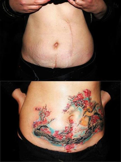 Scar cover up.... Stretch Mark Tattoo, Tummy Tattoo, Scar Cover Up, Tattoos To Cover Scars, Belly Tattoos, Belly Tattoo, Scar Tattoo, Stomach Tattoos, Tattoo Cover-up