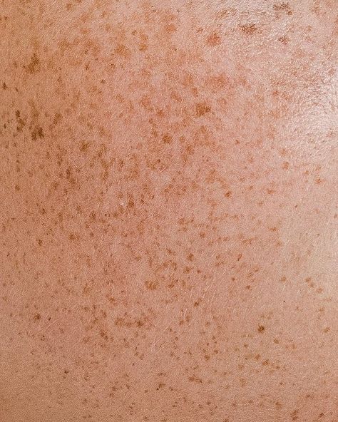 Human Skin Texture, Model Portraits, Beauty Pie, Beauty Technology, Dorset England, Beauty And Skincare, Dr Hauschka, Texture Photography, Skin To Skin