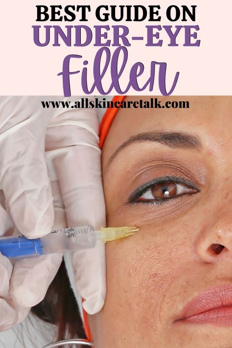 Under Eye Filler Before and After Under Eye Wrinkles Filler, Undereye Fillers Before And After, Eye Fillers Before And After, Filler Under Eyes Before And After, Undereye Filler Before And After, Botox Under Eyes Before And After, Under Eye Filler Before And After, Botox Under Eyes, Under Eye Filler