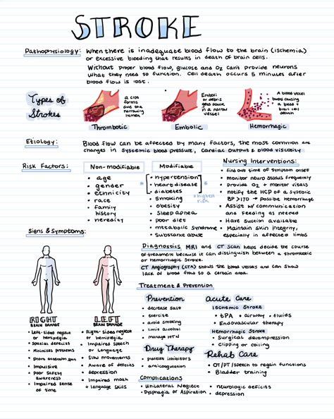 The most important info to study as a nursing student about strokes. Neuro Med Surg Nursing, Nursing Tips Student, Emt Study Notes, Pre Nursing Student Tips, Fundamentals Of Nursing Study Guide, Medical Surgical Nursing Notes, Nursing Student Essentials, Medicine Notes Study, Nurse In The Making Study Guides