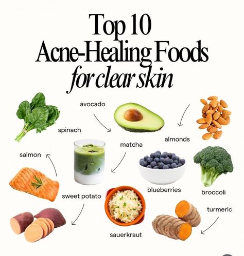 Foods For Clear Skin, Food For Glowing Skin, Balanced Diet Plan, Holistic Diet, Healing Foods, Healthy Hormones, Healthy Groceries, Nutrient Rich Foods, Healthy Routine