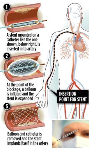 Heart Surgeon, Summer Health, Cardiac Nursing, Health And Fitness Magazine, Healthy Diet Tips, Daily Health Tips, Medical Knowledge, Cardiovascular System, Fitness Advice