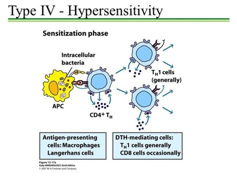 Hypersensitivity Type IV: Mechanism and Clinical Manifestation – Microbe Online Hypersensitivity Types, Langerhans Cell, Hypersensitivity Reactions, Types Of Diseases, Biology Lessons, Biology Notes, Medical Anatomy, Medical Laboratory, Chronic Inflammation